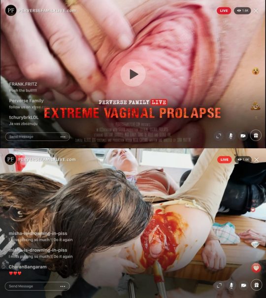 Perverse Family Live: Extreme Vaginal Prolapse